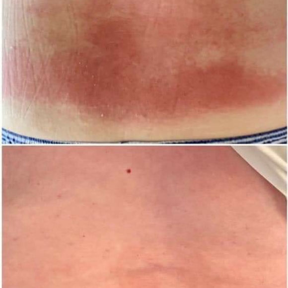 PRE-ORDER ONLY Stretch Mark & Multi-Tasking Cream - Picture 2 of 8